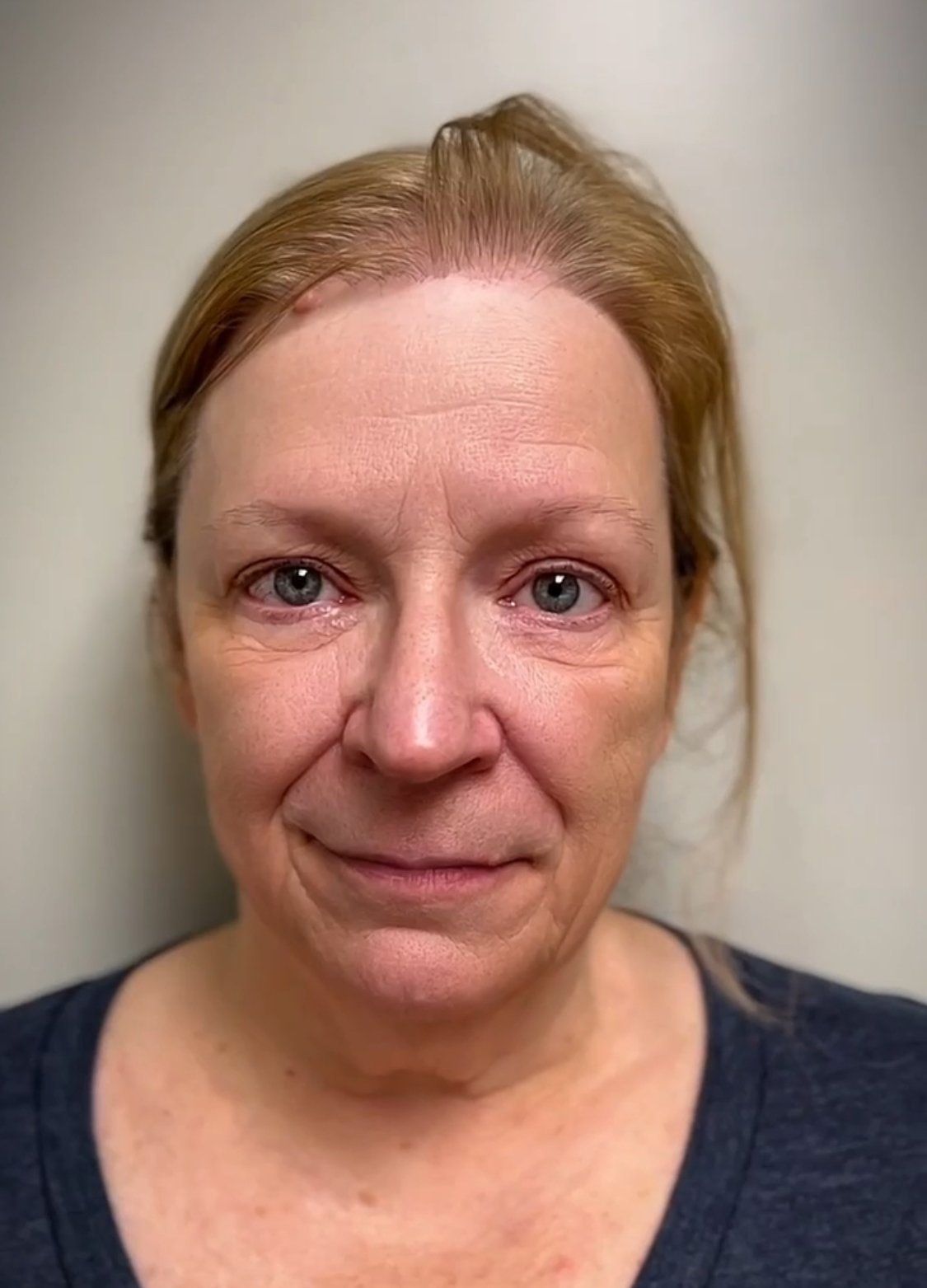 Beauty treatment portrait, image 1