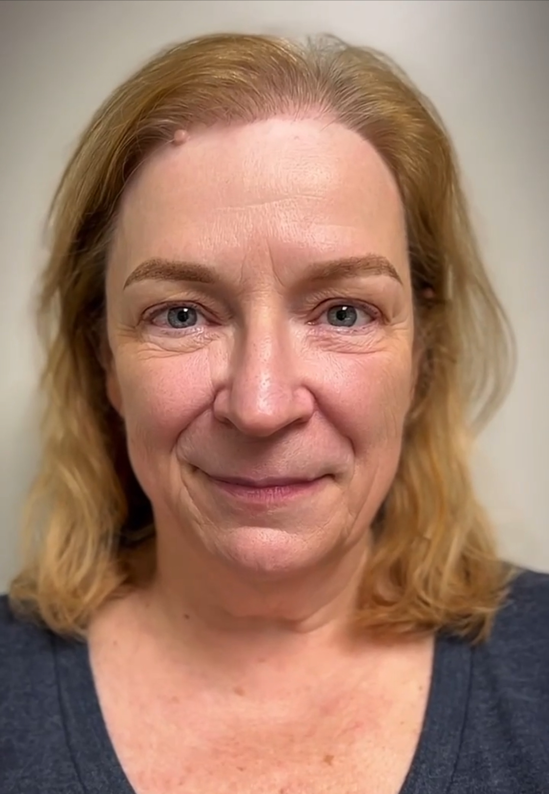 Beauty treatment portrait, image 2